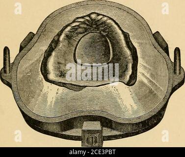 . Un manuel de la dentisterie mécanique et de la métallurgie . de manière plus grossière, l'effet de la stipuler est très agréable. Méthode de flowlashage.—le flowlashage ou l'investissement de la thecase devraient recevoir tout autant de soin que dans le travail en caoutchouc.commencez par monter le modèle haut dans la moitié peu profonde de la fiole, spécialement conçu pour celluloïd. Versez ensuite le plâtre fin jusqu'à ce qu'il atteigne le bord inférieur de la plaque. Lorsque le plâtre est suffisamment mis, le couper à la forme appropriée pour la séparation, puis le recouvrir avec le savon liquide. Placer l'anneau profond de la fiole en place et remplir TRÈS soigneusement LA CELLULOÏDE COMME BASE DENTAIRE. 67 Banque D'Images