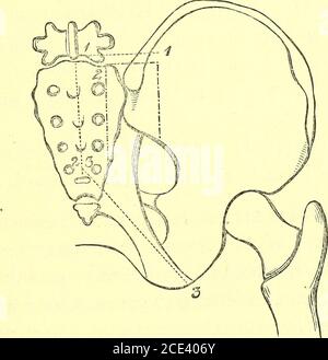 . Un manuel de dissection du corps humain [ressource électronique] : pour l'utilisation des étudiants et plus particulièrement pour ceux qui se préparent aux examens supérieurs de l'anatomie . anyant les nerfs précédents cutaneoussbranches des artères sacrales latérales. 4. Les braoches cutanées des artères glutéales et sciatiques au-dessus du Sacrum, et la branche Coccygeale du thélatter à la partie inférieure de l'os, ramifie également LE PLEXUS SACRÉ DE L'ARRIÈRE. 10» de l'artère glutéale perforant le muscle Glutéusmaxima.5. Petits filaments des branches externes des divisions primaires postérieures de la partie supérieure du thréelu Banque D'Images