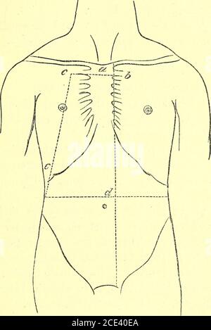 . Un manuel de dissection du corps humain [ressource électronique] : Pour l'utilisation des étudiants et plus particulièrement pour ceux qui se préparent aux examens supérieurs dans l'anatomie . clun et l'appendice, la pointe de l'appendice auriculaire gauche, la rainure auriculo-ventriculaire, la partie supérieure du ventricule droit, et le com-commencement des artères coronaires droite et gauche. 7. Une autre partie du plexus cardiaque superficiel des nerfs. 8. Le plexus cardiaque profond se trouvant sur la bifurcation de la trachée, avec ses radicules entrant dans celle-ci depuis le dessus. Une dissection pour exposer le Vena AzygossMajor. Position.—T Banque D'Images