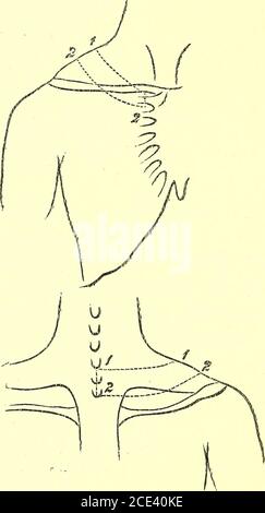 . Un manuel de dissection du corps humain [ressource électronique] : pour l'utilisation des étudiants et plus particulièrement pour ceux qui se préparent aux examens supérieurs de l'anatomie . rvical spinous processus, à la limite inférieure de l'extrémité intérieure de la clavicule atits articulation avec le sternum. 2. Du deuxième processus spineux dorsal à la bordure supérieure du second cartilage Costal au niveau du Ster-num. 3. Incisions verticales joignant les extrémités antérieure et postérieure de la précédente. Le rabat ainsi retiré traverse devant le tiers médian de la clavicule. Il y aura maintenant exposé le f superficiel Banque D'Images