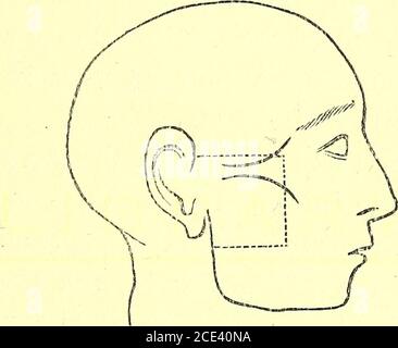 . Un manuel de dissection du corps humain [ressource électronique] : pour l'utilisation des étudiants et plus particulièrement pour ceux qui se préparent aux examens supérieurs de l'anatomie . scia. LE TUBE EUSTACHE. 19 II Retirez-le et exposez-le— 1. Le Zygoma. 2. Le fascia temporal juste à sa fixation au Zygoma. 3. Le fascia parotide, qui couvre le muscle du masseur, et un petit morceau du fascia buccal devant. 4. Les branches temporales, malaires et infraorbitales du nerf facial émergeant de la glande parotide. 5. L'artère faciale transverse et la veine parallèles et en dessous du Zygoma. Banque D'Images