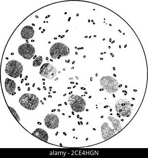 . Microörganismes pathogènes; un manuel pratique pour les étudiants, les médecins et les agents de santé . zones de nécrose ponctuée. En général, il y a 424 MICRO-ORGANISMES APPARTENANT À l'excès de liquide DU GROUPE DE SEPTICÉMIE dans la cavité pleurale. Dans la maladie plus chronique, on trouve des abcès des ganglions lymphatiques périphériques ou, plus communément, des foci purulents ou spléniques mesentericor. Souvent, les ratssoumis à l'examen sont mal décomposés, mais des cultures pures du bacille de la peste peuvent être facilement obtenues en appliquant le matérialdes lésions à l'abdomen fraîchement rasé d'un cobaye. La Banque D'Images