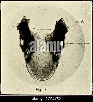 . Fièvre du Texas dans les îles Philippines et l'extrême-Orient. . Boophilus aitstralis Fuller : mandibule en gaine. (100 X.) a, mandibule; 6, Sheath;c, digit of mandibule; d, apholyse interne; e, apholyse externe. /C. /MT^ ^ J. b.l / . -/ ?• B. australis Fuller: Mandibule en gaine, montrant une gaine de type shagreen près de a. (1000 X.). B. australis Fuller: Scutellum de la femelle, montrant des projections antero-dorsc-lateralau et et des yeux à a. (19 X.) Banque D'Images