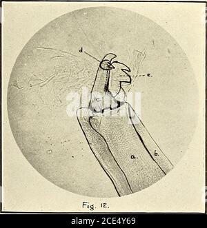 . Fièvre du Texas dans les îles Philippines et l'extrême-Orient. . Boopkilus austratit Fuller: Pattes gauches de la femelle, montrant des griffes. (12 X.). Boophilus aitstralis Fuller : mandibule en gaine. (100 X.) a, mandibule; 6, Sheath;c, digit of mandibule; d, apholyse interne; e, apholyse externe. /C. /MT^ ^ J. b.l / . -/ ?• B. australis Fuller: Mandibule en gaine, montrant une gaine de type shagreen près de a. (1000 X.) Banque D'Images