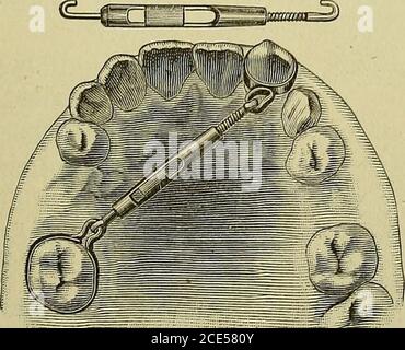 Orthodontie ou malposition des dents humaines sa pr vention et