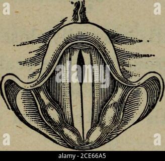 . L'hygiène des organes vocaux : un manuel pratique pour les chanteurs et les orateurs . Figure 9.—laryngoscopie vue de la glotite femelle dans la production d'une High Note (long Reed). Les voies se produisent dans la partie postérieure de la glotite liga-menteuse et parfois à la partie antérieure 7° HYGIÈNE DES ORGANES VOCAL, aussi. Dans les premiers cas, il y a une ouverture elliptique qui s'étend jusqu'à la commissure antérieure des cordes vocales; dans le second, l'ouverture elliptique occupe le tiers de l'énigme de la glottis ligamentaire. La fermeture de la partie postérieure du glottisne semble pas être une importation très importante Banque D'Images