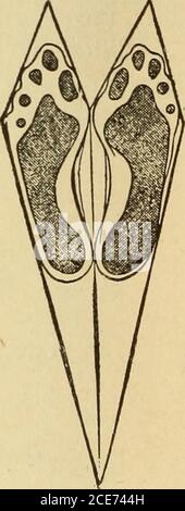 . M. Evans's Comment bien garder; . Figure 266.—UN pincement nocif de forme étroite. COUVRANT LES PIEDS que le détenu de la maison d'hébergement soit un tramp ou un travailleur saisonnier, si il est sage qu'il se gardera équipé de chaussettes chaudes. Pourtant, la COUVERTURE de Flynt DES PIEDS 767 Banque D'Images