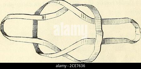 . Manuel de petite chirurgie . Figure 40. Fig. 11. simple ou double (fig. 40 et 41 ), le nœud dallonge (fig. 42),. SIF;. 42. CHAPITRE IV DES I1EDICÂMENTS Les topiques sont des médicaments appliqués à la face de la peau, ou destinés à une entrée des cavités natulles, mais qui ne traverse pas le revers de la peau. Daprès leur consistance, on peut divisier les topiques en solides,licides et gazeux. Les topiques mou, qui sont le milieu entreles solides et les liqueurs, sont en composants généraux dune partie et dune partie solide. Daprès leur action sur lorganisme, Banque D'Images