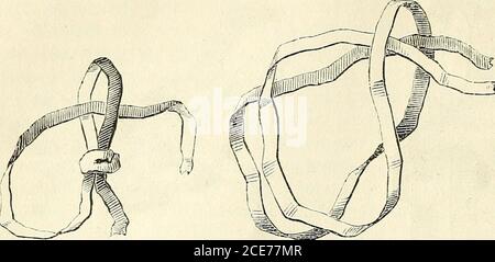 . Manuel de petite chirurgie . Figure 38. Fig., 39. Constitué par une rosette simple fait sur lun des chefs & lt;Ju lien 22 DKS MÉDICAMENTS. Dans danse duquel on passe-lautre chef: le nœud coulanl. Figure 40. Fig. 11. simple ou double (fig. 40 et 41 ), le nœud dallonge (fig. 42), Banque D'Images