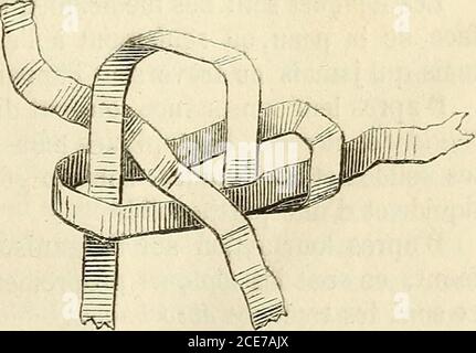 . Manuel de petite chirurgie . Figure 38. Fig., 39. Constitué par une rosette simple fait sur lun des chefs & lt;Ju lien 22 DKS MÉDICAMENTS. Dans danse duquel on passe-lautre chef: le nœud coulanl Banque D'Images