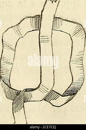 . Manuel de petite chirurgie . Figure 36. Fig. 37. le nœud demballeur (llg, 38), le nœud de tisserand (fig. 39). Banque D'Images