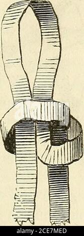 . Manuel de petite chirurgie . Figure 32. Fig. 33.(fig. 32), le nœud double (fig. 33), la rosette simple (fig. 34), le nœud simple et h rosette simple superposés [tig. 35), le nœud sim-. Banque D'Images