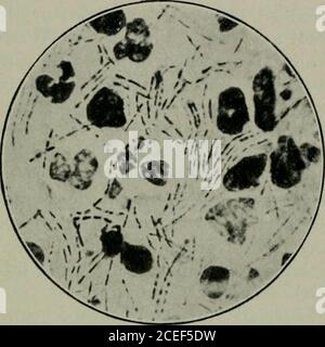 . Micro-organismes pathogènes, y compris les bactéries et le Protozoa; un manuel pratique pour les étudiants, les médecins et les agents de santé. la réaction locale de tle se produit immédiatement au point d'inoculation, mais au-delà de cela, il y a un œdème important des tissus. Très peu de bacilles se trouvent dans les grands vaisseaux, mais dans les organes internes, et surtout dans les capillaires du foie, des reins et des poumons, ils sont prétentin grand nombre. Dans certains endroits, comme dans les glomérules des reins, les capillaires seront vus être remplis de bacilles, et les hémorragies, probablement à cause de Banque D'Images