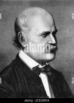 Ignaz Semmelweis. Portrait du médecin et scientifique hongrois, Ignaz Philipp Semmelweis (1818-1865), gravure par Jenő Doby, 1860 Banque D'Images