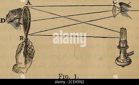 . L'ophtalmoscope : son mode d'application expliqué, et sa valeur montrée, dans l'exploration des maladies internes affectant l'oeil. Nous l'avons vu à travers le télescope astronomique plus moderne. 8 L'OPHTALMOSCOPE. Les illustrations de Ruetes sont très caractéristiques, bien-markedchangements de structure; quelques dessins de son atlas arereproduit dans ma frontispice. L'ophthalmoscope dont je fais usage est un petit circularmirror, en effet rien de plus que le miroir argenté fait foran microscope ordinaire, ayant un trou percé dans son centre, et monté dans un morceau de tortoiseshell.* cette forme d'instrument Banque D'Images