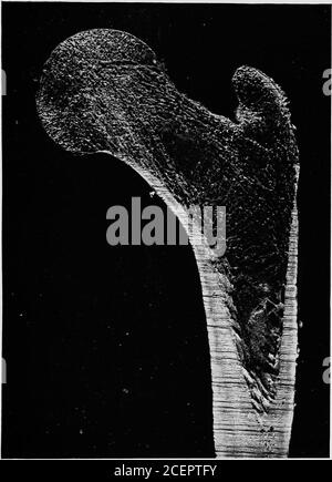 . Sur la désoformation, sa relation à la tension et à la pression;. Schéma. Figure 2 Banque D'Images