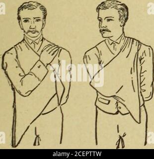 . Médecine moderne et revue bactériologique. Figure 31.—bandage à nombreuses queues. ?qui quelques dix-huit ImbricatedStrips plus courts (Fig. 31) sont cousus à des nœuds droits. Le membre est posé sur le bandageso que son axe correspond à la bande cen-tral et, à partir de la périph-ery, les bandes sont doucement et firmlyrepliées comme indiqué sur le schéma. APIN de chaque côté, fixant les deux laststrips à leurs prédécesseurs, sert tofasten tout en toute sécurité. En sortant les broches,. A i Figs. 32 et 33.—le mouchoir triangulaire soutient le coude, a et i. et tire les queues vers la droite et la gauche, l'ensemble du banda Banque D'Images