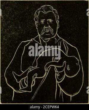 . Médecine moderne et revue bactériologique. Il larynx et trachée, servingto élever et maintenir ouvert l'épiglottis (démontré par Benjamin Howard dans son excellent article, A New and OnlyWay of Raising the Epiglottis, BritishMedical Journal, novembre 1888). La partie supérieure du dos et le scapulaerest dans la paume de la main, - les autres trois flèches sont insérées dans l'aisselle du bras gauche de thebabs, le soulevant vers le haut et vers l'extérieur. (Voir Fig. 1.) Ensuite, avec la main droite, si le bébé est grand et lourd, saisissez les genoux de manière à les tenir avec le genou gauche reposant entre le tum Banque D'Images