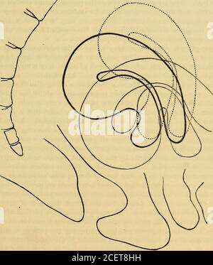 . Un système de médecine, basé sur la loi de l'homéopathie. Tuée à l'internalos uteri. En général, la moitié supérieure du col de l'utérus et la moitié inférieure du fond sont impliquées dans le virage. La flexion peut être vers l'avant, vers l'arrière, ou de chaque côté, et peut être associée à prolapsus ou toute forme de version; rarement l'utérus est déformé sans aussi beingdislocated dans son ensemble. Il y a plusieurs conditions pathologiques consécutives à la flexion.en premier lieu, il y a un gonflement des tissus sur le côté concave du pli. Cette crête ou élévation est souvent si proéminente que pour DIKASKS DE T Banque D'Images