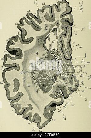 . Anatomie des centres nerveux. Fétérie, lautre supérieure-rieure, par une couche festonnée de substance blanche, connexe sous le nom de lame médullaire moienne (LMM) ou de lamina uta. Elle se compose de l'entrée du périphérique du trigone et de la lame médullaire moienne. Le ventricule latéral est encore mis en forme par deux parties complimentesséparées, la corne sphènoïdale (Vsph) en bas et en avant, le carrefour ventriculaireet la corne occipitale (COV) en arrière. La corne sphénoïdale (Vsph) est flèche avant en arrière. Banque D'Images