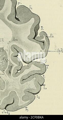 Anatomie Des Centres Nerveux M A E T Ir Y Ci Jh V Ta Ir Ma S Fi T H Q Il Fig 2i6 Coupe Vertico Transverse De Lhemispha Re Dra Na 66 Passant A 66 Milli Ma Tres En