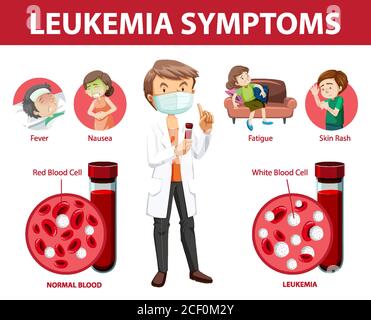 Illustration graphique illustrant les symptômes de la leucémie Illustration de Vecteur