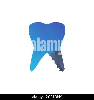 illustration du modèle de conception de vecteur de dents implantées Illustration de Vecteur