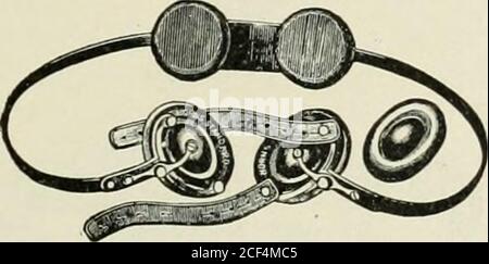 . Hernie abdominale : son diagnostic et son traitement. 4. Barre de durcissement radical modifiée.. 145 k.idiLal-cure iruss. Banque D'Images