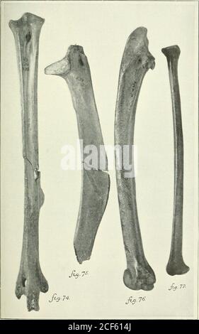 . Transactions. SHUFELDT: OISEAUX FOSSILES IX MARSH COLLECTION DE LA PLAQUE XI DE L'UNIVERSITÉ DE YALE FIG. 74. tarso-métatarse droit (ad.) du marais Meleagris alius. Anterioraspect, taille nat. Fracturé par le centre de l'arbre. Le noyau de Calcar est illustré, mais n'est pas de grande taille. Les Trochleae ont une taille légèrement réduite par l'usure. Fossile. Figure 75. Scapula gauche, vue d'en haut. (Ad.) Meleagaris alius de ]Iarsh.distal extrémité cassée, et complète fracture transversale de la lame à son milieu; imparfaite extrémité antérieure. Figure 76. Aspect radial de l'ulna gauche de Meleagris alius ]Marsh (s^•non3^n OFM. Superba Cope). (A Banque D'Images