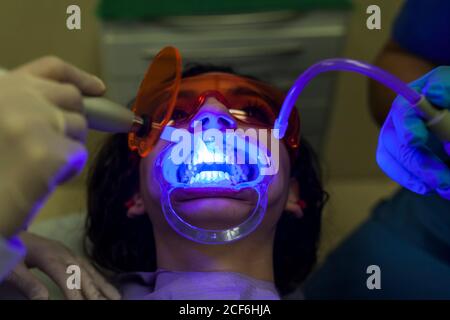 Mains de dentiste et d'assistant examinant et faisant ultrasons clair jeune dents de patient femelles avec équipement spécial avec lumière bleue dentisterie Banque D'Images