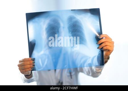 Vue de face d'une jeune femme médecin en uniforme image radiographique sur le mur dans la salle Banque D'Images