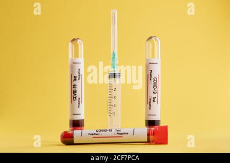 Tubes à essai avec échantillons de sang et seringue utilisés pour le COVID 19 diagnostic sur fond jaune Banque D'Images