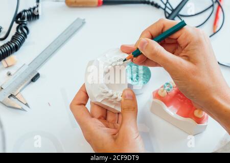 De dessus de la récolte orthodontiste avec un crayon dans la main de travail avec moule dentaire blanc à la table avec équipement professionnel Banque D'Images