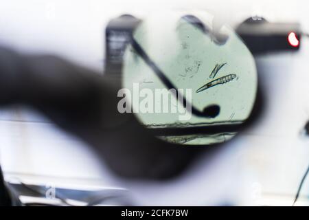 Vue de dessus des cheveux avec de petits parasites placés sous la lentille de microscope moderne en laboratoire Banque D'Images