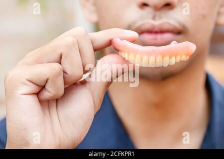 Un homme tient des prothèses dentaires entre ses mains. Dentiers amovibles flexibles. Fausses dents. Banque D'Images