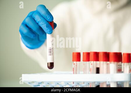 Main gantée de l'employé de laboratoire mettant un petit flacon avec échantillon de sang dans la cellule Banque D'Images