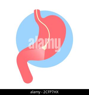 Icône de gastroscopie. Endoscope avec lumière dans l'estomac. Examen médical. Inspection de l'estomac. Problèmes digestifs. Tuyau avec caméra. Dessin animé plat Illustration de Vecteur