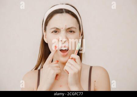 Portrait d'une jeune femme avec la varicelle couché au lit et mesurant température Banque D'Images