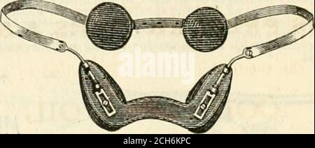 . Hospital Gazette and Archives of Clinical Surgery . l.i&lt;-ctr()-Ma^nctii:, and t.alvancistic AP-Jiaratuses ensemble avec des électrodes supérieures. Pour savoir tlie authentique.pparatus de This]iurious, adresse ForIllustrated catalogue, Dr. Jerome Kidder, N. K. COK. DE 17th St. & 4th av., Nkw Yokk. PiIF. L'attention des médecins et de tous les personnages rompus est appelée à la TRUSS UNIVERSELLE VICTOR. PAS DE BANDE DE GRIPPING AUTOUR DU SYSTÈME HIPS. PAS DE GRIPPAGE UNDERSTRAP. AUCUNE FRICTION SUR LA PEAU. S'ADAPTE À TOUS LES MOUVEMENTS DU CORPS. NE SE MET JAMAIS HORS SERVICE. S'USE PLUS LONGTEMPS QUE TOUTE AUTRE BARRE. PLAQUE ARGENTÉE Banque D'Images