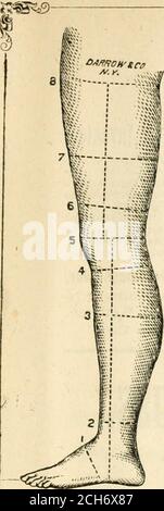 . Hospital Gazette and Archives of Clinical Surgery . n modification du Numberof the Red Bloud corpuscules in syphilis. Par E. L. Keyes, M. D., New York, p. 23. 6. Sur la striction comme cause initiale de Gleet, avec des remarques sur le Caliber Urethral. Par F. N. Otis, M. D., New York, p. 30. 7. La construction, l'entretien et l'utilisation appropriés de l'appareil Galvano-Cau-tery. Par Henry G. Piffard, M. D., New York, p. 15. 8. Une contribution à la chirurgie obstétricale. Par Alex. J. C. SKENE, M. D., Brooklyn, p. 2. 9. Gastro-Elytrotomy a réussi. Par Alex. J. C. SKENE, M. D., Brooklyn, p. 4. 10. Lesi syphilitique Banque D'Images