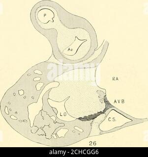 . La revue américaine de l'anatomie . WfrWs 4S$MZfr*ms& 2425 P. Cu. Section transversale du coeur d'un embryon de 11 mm de long (No 353). X 33.dessin agrandi du carré illustré à la Fig. 24 incluant le muscle auriculo-ventriculaire 25 288 FRANKLIN P. MALL. Figure 26 coupe transversale. Embryon 16 mm. (Non 317). X 40. R.A. 27 ■-^ Fig. 27 Section coronale à travers le coeur d'un embryon 21 mm de long (No 460).UN carré est autour du muscle auriculo-ventriculaire. DÉVELOPPEMENT DU CŒUR HUMAIN 289 ML &^. Banque D'Images