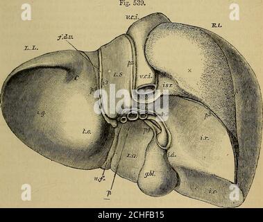 . Les éléments de l'anatomie de Quain . r bordure, mais aussi des parties de ce qui ont jusqu'ici beenreckoned comme appartenant à la sous-surface, viz. un pai-t du lobe gauche, et l'ensemble du lobe Spigelien), regarde complètement en arrière, et peut donc je FOEM OP LE LIYEE. 621 être décrit plus correctement comme formant une troisième face ou une face postérieure. Cette description du mode des surfaces sera donc suivie ici. La surface supérieure de l'organe est convexe, lisse et recouverte de péritoine. Il est marqué OS dans une partie droite, large et convexe, et une partie gauche, plus petit et plus plat, par la ligne de Banque D'Images