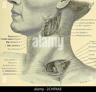 . Texte-livre de chirurgie opératoire . ^agus ou nerf sensoriel acutané doit être considéré. L'auteur a étiré le nerf Avith bénéfice permanent dans un cas d'acuteneuralgia limité au nerf laryngé supérieur. (5) nerf laryngé inférieur. La paralysie du nerf laryngé inférieur est une complication acommon dans le goitre, et se produit encore plus fréquemment après l'excision de la CHIRURGIE DES NERFS PÉRIPHÉRIQUES INDIVIDUELS -!&gt;?&gt; thyroïde, surtout si l'opération tlie a été effectuée par un chirurgien wlio n'a aucune grande expérience de la branche de la chirurgie tliis. Heureusement le enrouement qui résulte fr Banque D'Images