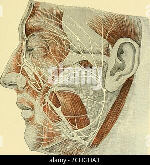 . Texte-livre de chirurgie opérative . ron, Berlin, 1905. SURGERV DES NERFS PÉRIPHÉRIQUES INDIVIDUELS 217 Rollets l'opération, dans laquelle les incisions de la peau correspondent à la ligne de tlie à laquelle les tlie boneis se divisent, est également une excellente méthode en ce qui concerne la direction de l'incision de la peau. Les tumeurs dans les parties supérieure et interne de l'orbite doivent être approchées par voie adiféente si le globe oculaire doit être préservé, à savoir, par notre incision normale, en exposant la partie supérieure de la cavité nasale. Une incision est faite de la sourcils au pont du nez. L'os nasal et le processus nasal de la partie supérieure du maxi Banque D'Images