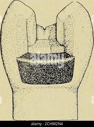 . Techniques d'anatomie opératoire et dentaire; manuel de classe et de laboratoire pour les étudiants en médecine dentaire de première année . Figure 198.—le mur de gingival recouvert. Figure 199.—construire le long de la paroi axiale. Banque D'Images