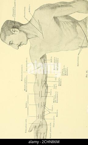 . Texte-livre de chirurgie opératoire . - 3.J de résection du rectum (incision parasacrale). Sciatique a. et nerfs. Figure 40. avec les nerfs sensoriels supra-clavimdar. En divisant le fascia, nous devons éviter la veine céphalique au bord antérieur du deltoïde. Les fibres claviculaires du pectoralis majeur sont maintenant divisées, et la veine céphalique, avec les branches de l'artère acromio-thoracique et les nerfs thoraciques antérieurs, est tirée vers le haut. La CHIRURGIE OPÉRATOIRE. Banque D'Images