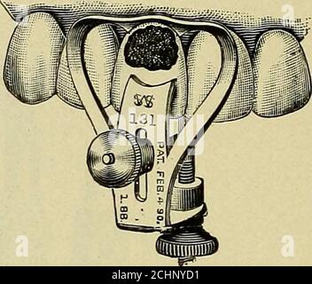 . Techniques de l'anatomie opératoire et dentaire; manuel de classe et de laboratoire pour les étudiants en médecine dentaire . m luiiimiiiiJiiiii* Fig. 112.—pince cervicale ivoire. Figure 113.—Johnson cervicarcamp.. Banque D'Images