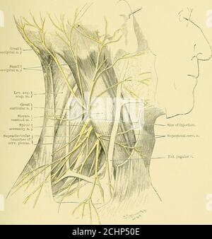 . Texte-livre de chirurgie opérative . de du cou et de la région de l'oreille peut être rendu insensible par injection le long du tiers médian de la bordure postérieure du sternomastéroïde. Thisimplique les petits nerfs occipitaux, les grands nerfs auriculaires et les nerfs cervicaux superficiels. Theregion inunedialement en dessous de ceci, en suite avec la partie supérieure de la thoraxanteriorly, peut être rendu insensible en injectant les supracicularbranches descendantes des nerfs cervicaux (Fig. 13). L'anesthésie du larynx est obtenue par cocaïnisation périnérale du supérieur AU DÉBUT DE L'OPÉRATION laryngée Banque D'Images