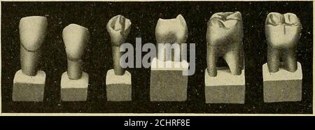 . Techniques d'anatomie opératoire et dentaire; manuel de classe et de laboratoire pour les étudiants en médecine dentaire de première année . FLG. 41.—sculpture terminée. Vue sur le labial et la langue. (d) avec la jauge millimétrique, mesurer la longueur de lacénelle de l'arête de coupe jusqu'à la future ligne cervicale sur la note.—les dessins illustrant la méthode de sculpture ont été réalisés par studentE. W. Nicdcrhofer, classe de 1915, Ohio College of Dental Surgery. 30 ANATOMIE DENTAIRE surface labiale, et marquer l'emplacement de la ligne cervicale (gin-gival, noir) avec le crayon. (e) indiquer l'emplacement, pris à l'aide de la jauge Boley, du futu Banque D'Images