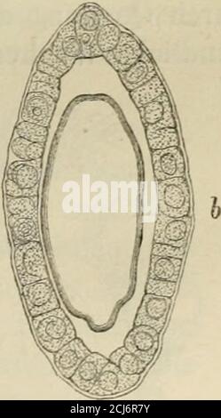 . Handbuch der specellen Pathologie und Therapie . Figure 9.VacUsartig glänzende Cylinder in den Lichtungen der ge-raden Harnltanälchen. Epithelialbesatz. (Heller.) 312 Bartels, Diffuse Kiaukheiten der Nieren. einige and ere in diesem Werke benutzte Zeichnungen sind mir ausColbergs Nachlass gütigst überwiesen worden. Die Zwisclieuräume zwischen den Harnkanälchen sind vielbreiter, als in der Norm, nach Klebs um das zwei- bis vierfache;ihre Breite soll nach demselben Autoft die Breite der gewenKanälchen erreichen. Die Figuren 9 und 10, letztere gleichfleiner Banque D'Images